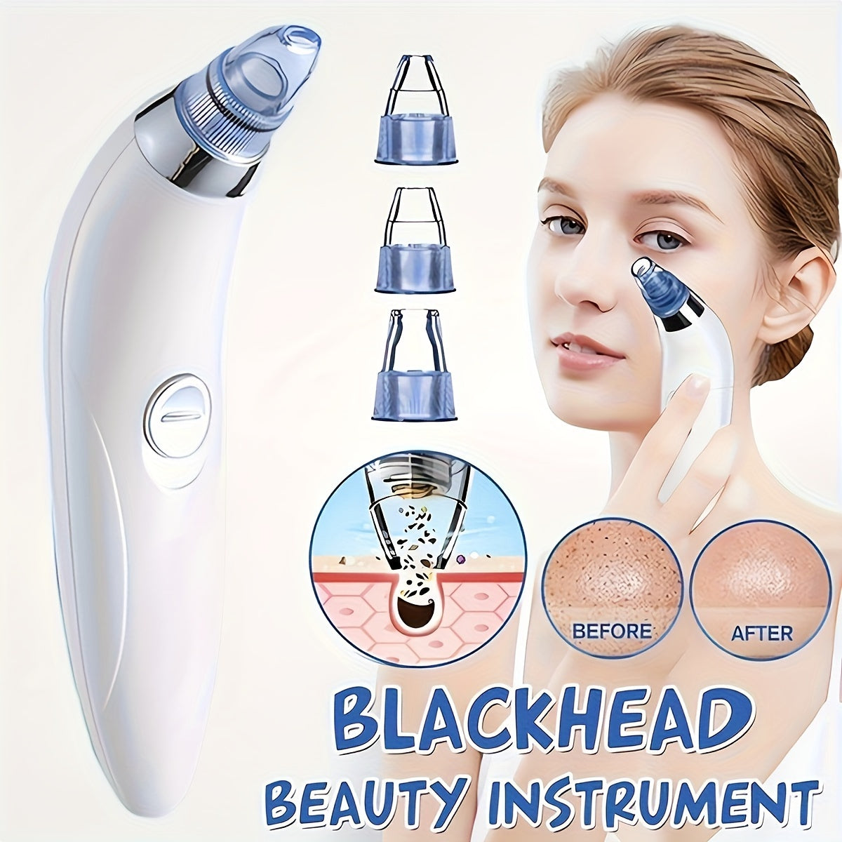 Portable Blackhead Vacuum Remover